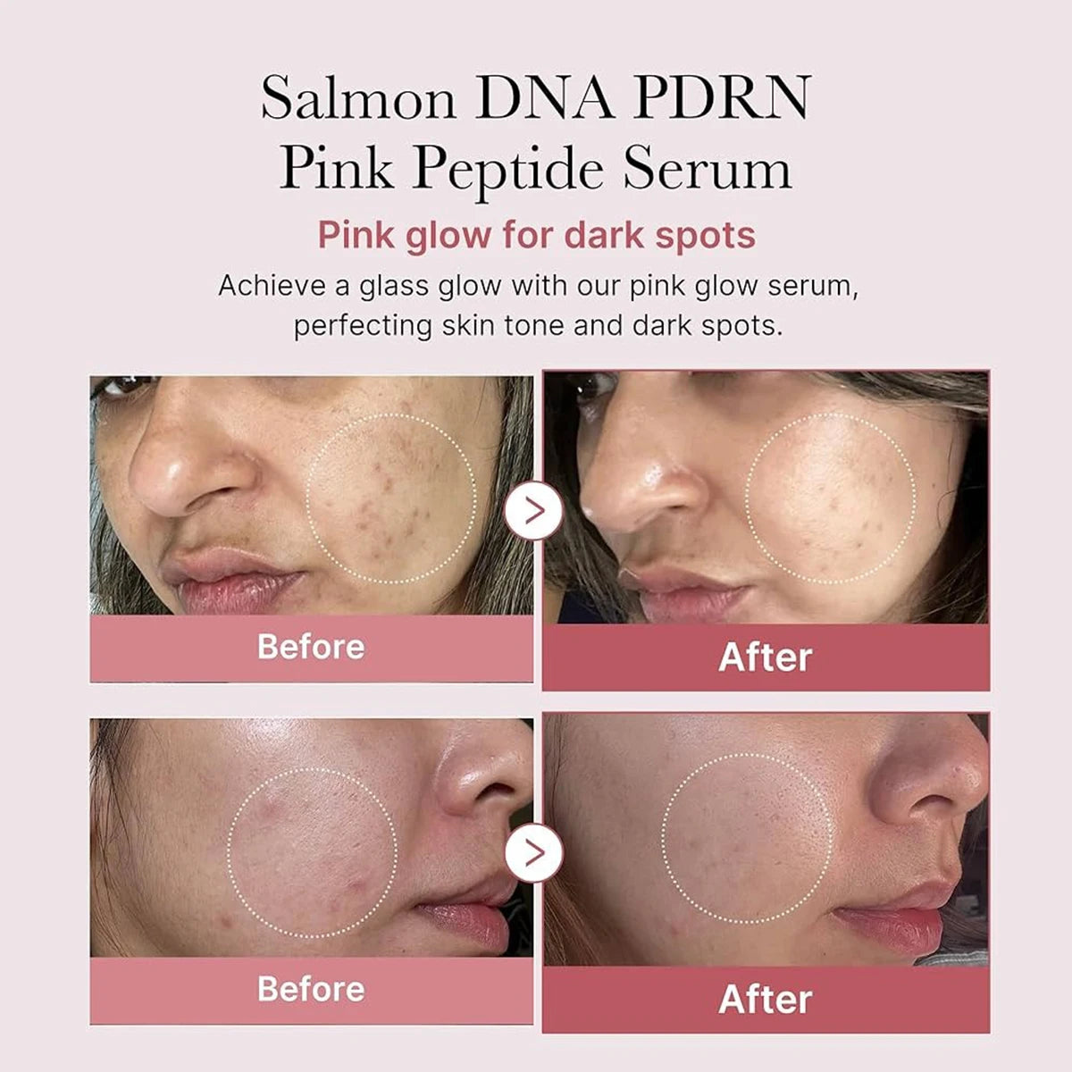 Medicube Salmon DNA PDRN Pink Peptide Serum,Serum Texture,Complex Repair Ingredients,Lifting & Firming,K-Beauty,Korean Makeup